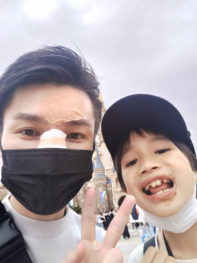 ディズニーに行く1ヶ月前から体調管理と怪我には注意しましょう⚠️